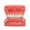Best ways to care for your dental implants