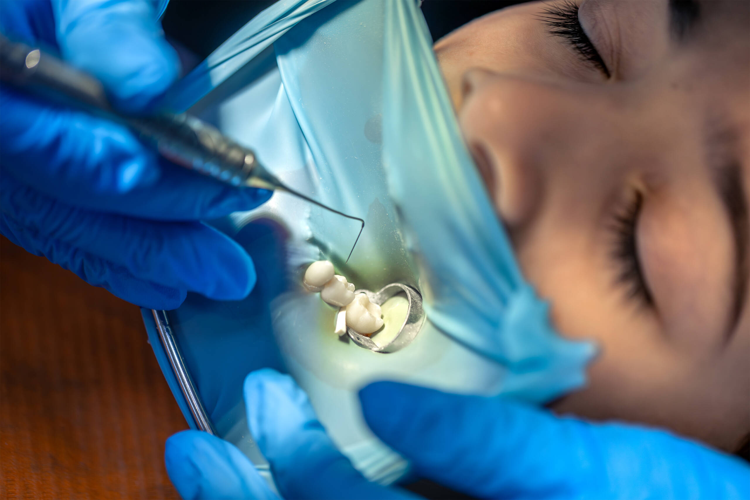 Endodonzia